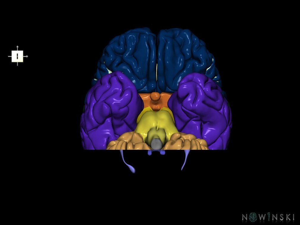 G7.T2.1-12.V6.Dp-50.C2.L0.Brain posterior cut–Cerebral ventricles