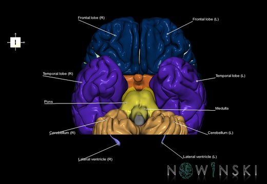 G7.T2.1-12.V6.Dp-60.C2.L1.Brain posterior cut–Cerebral ventricles