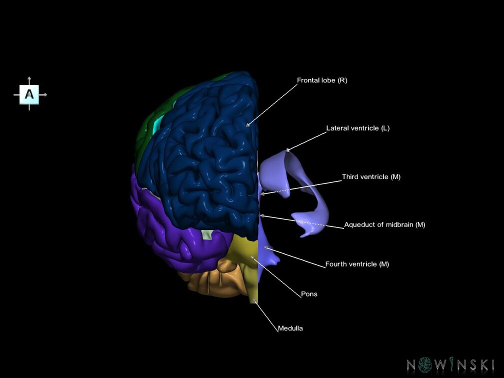 G7.T2.1-12.V1.Dl00.C2.L1.Brain left cut–Cerebral ventricles