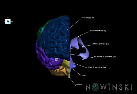 G7T2.1-12.BrainLeftRightCut-CerebralVentricles