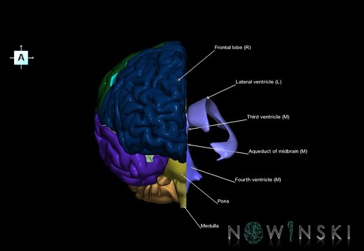 G7.T2.1-12.V1.Dl00.C2.L1.Brain left cut–Cerebral ventricles