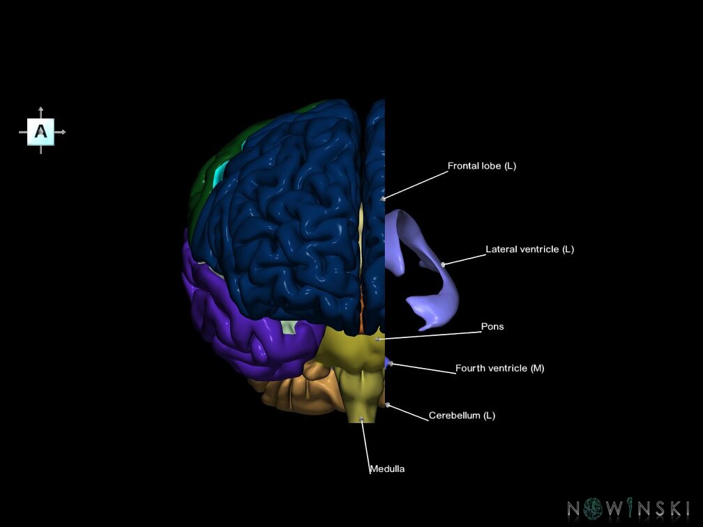 G7.T2.1-12.V1.Dl10.C2.L1.Brain left cut–Cerebral ventricles