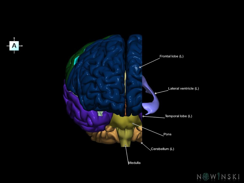 G7.T2.1-12.V1.Dl20.C2.L1.Brain left cut–Cerebral ventricles