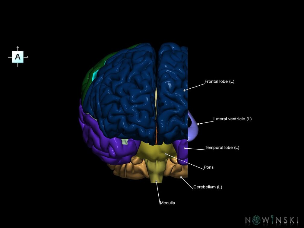 G7.T2.1-12.V1.Dl30.C2.L1.Brain left cut–Cerebral ventricles