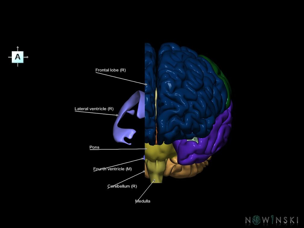 G7.T2.1-12.V1.Dr-10.C2.L1.Brain right cut–Cerebral ventricles