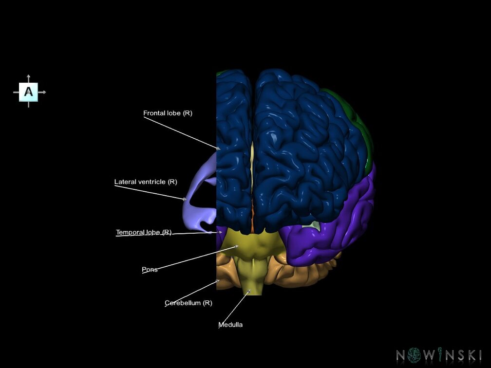 G7.T2.1-12.V1.Dr-20.C2.L1.Brain right cut–Cerebral ventricles
