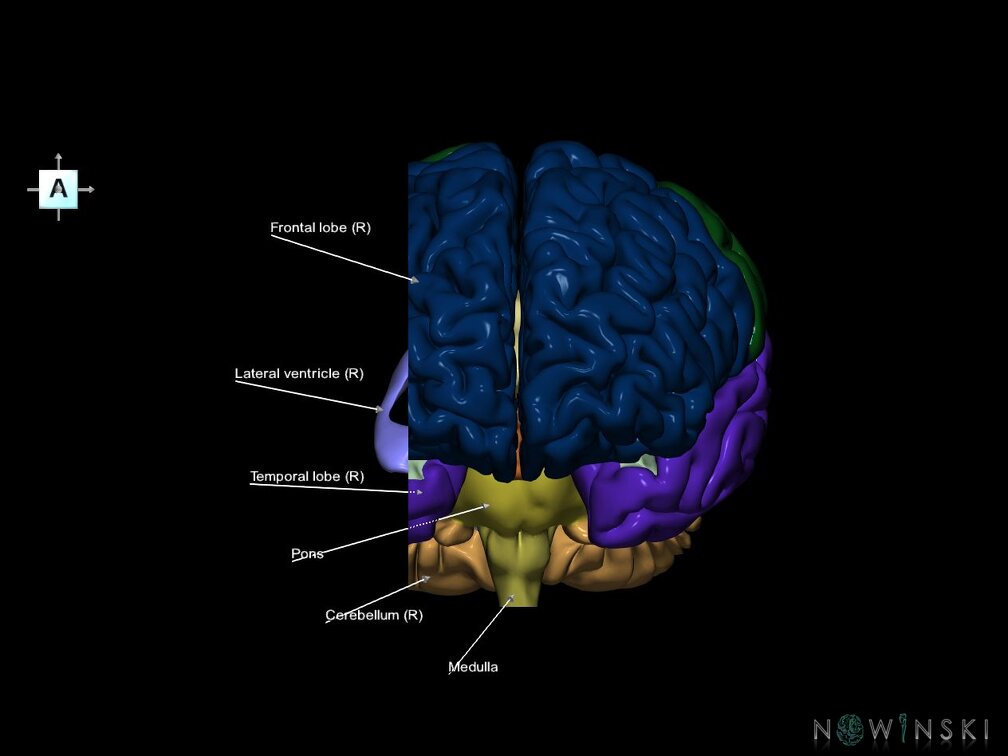 G7.T2.1-12.V1.Dr-30.C2.L1.Brain right cut–Cerebral ventricles