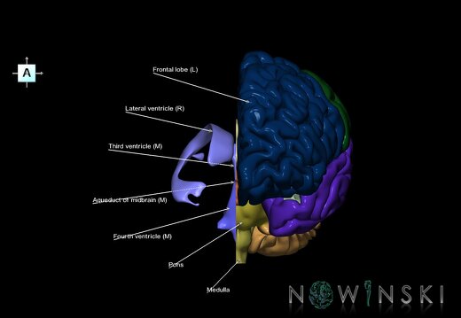 G7.T2.1-12.V1.Dr00.C2.L1.Brain right cut–Cerebral ventricles