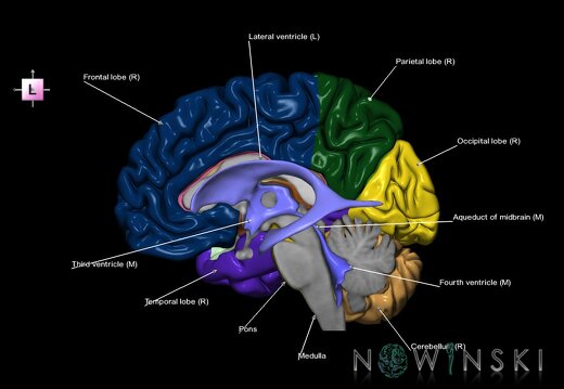G7.T2.1-12.V2.Dl00.C2.L1.Brain left cut–Cerebral ventricles