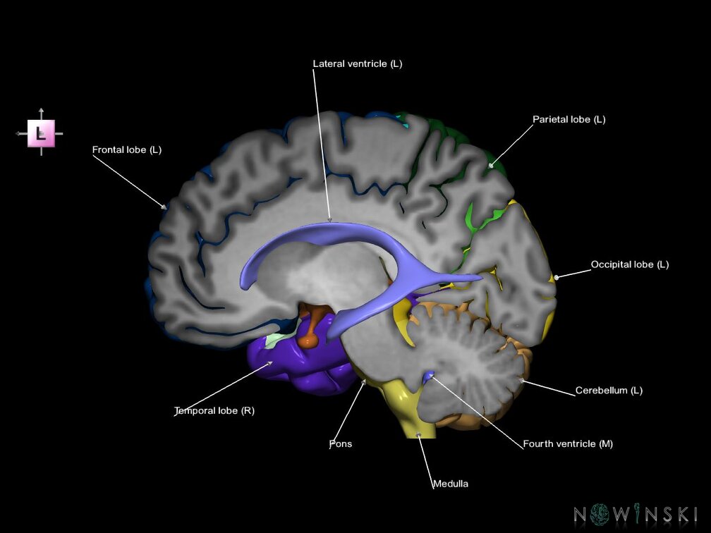 G7.T2.1-12.V2.Dl10.C2.L1.Brain left cut–Cerebral ventricles