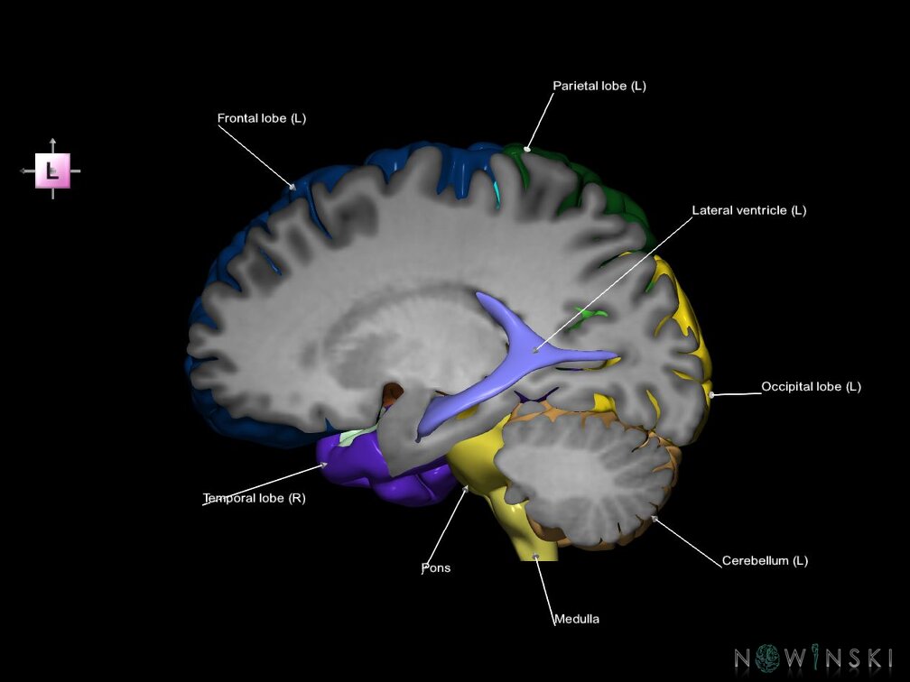 G7.T2.1-12.V2.Dl20.C2.L1.Brain left cut–Cerebral ventricles