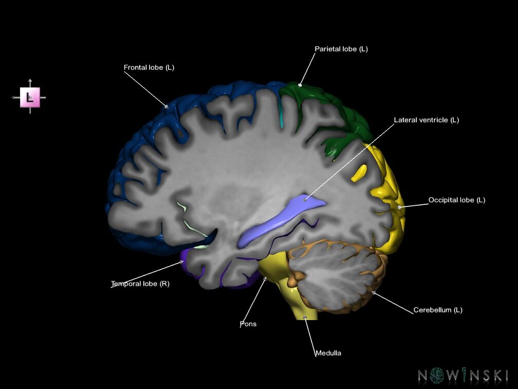 G7.T2.1-12.V2.Dl30.C2.L1.Brain left cut–Cerebral ventricles