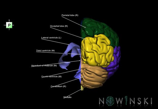 G7.T2.1-12.V3.Dl00.C2.L1.Brain left cut–Cerebral ventricles