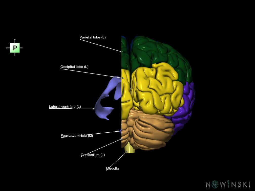 G7.T2.1-12.V3.Dl10.C2.L1.Brain left cut–Cerebral ventricles