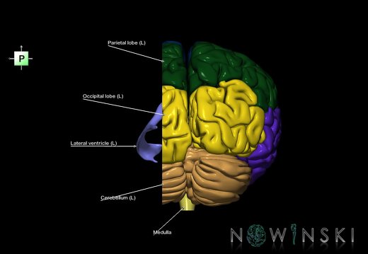 G7.T2.1-12.V3.Dl20.C2.L1.Brain left cut–Cerebral ventricles