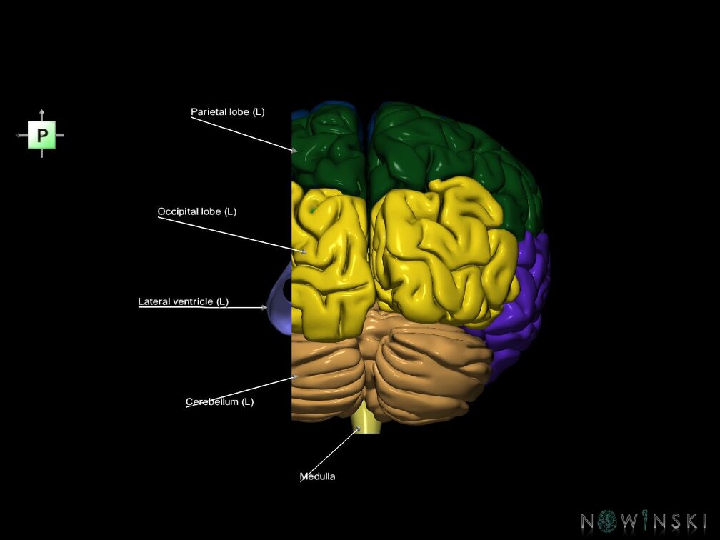 G7.T2.1-12.V3.Dl30.C2.L1.Brain left cut–Cerebral ventricles