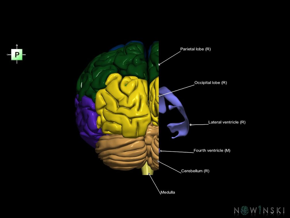 G7.T2.1-12.V3.Dr-10.C2.L1.Brain right cut–Cerebral ventricles