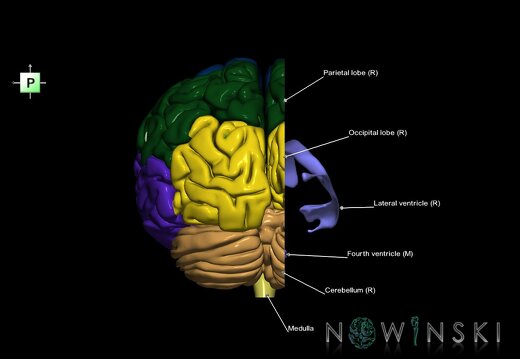 G7.T2.1-12.V3.Dr-10.C2.L1.Brain right cut–Cerebral ventricles