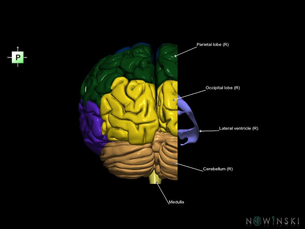 G7.T2.1-12.V3.Dr-20.C2.L1.Brain right cut–Cerebral ventricles