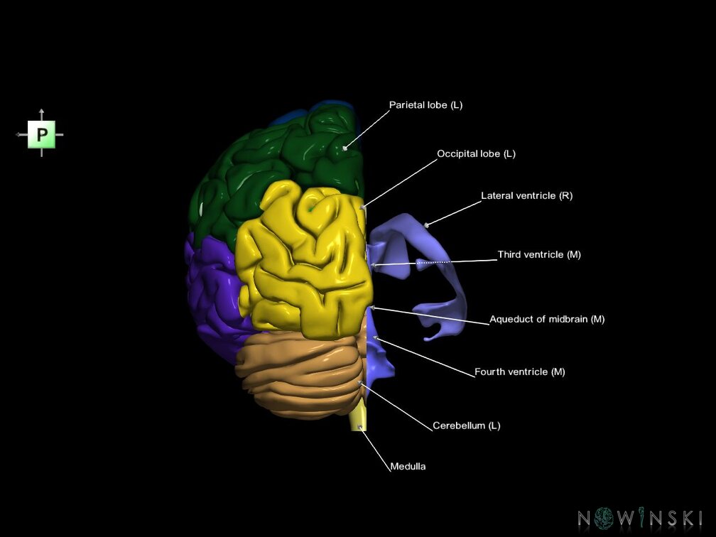 G7.T2.1-12.V3.Dr00.C2.L1.Brain right cut–Cerebral ventricles