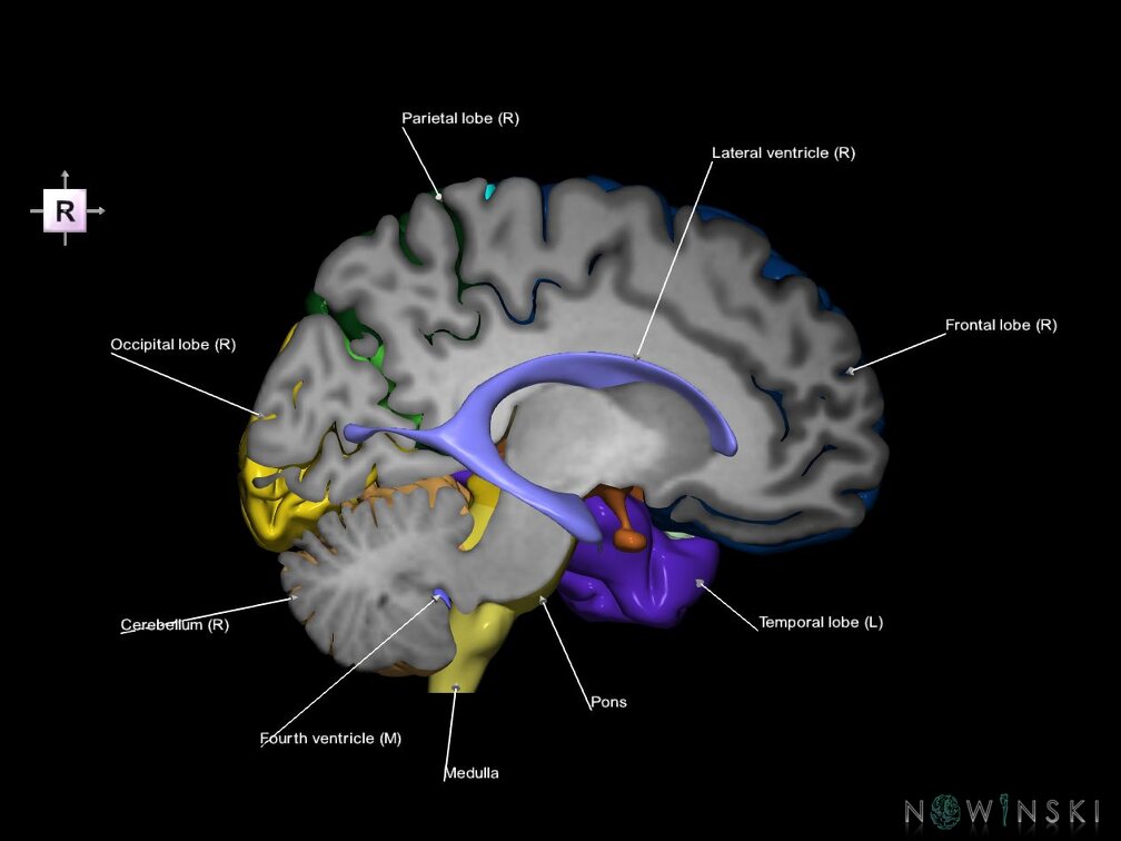 G7.T2.1-12.V4.Dr-10.C2.L1.Brain right cut–Cerebral ventricles