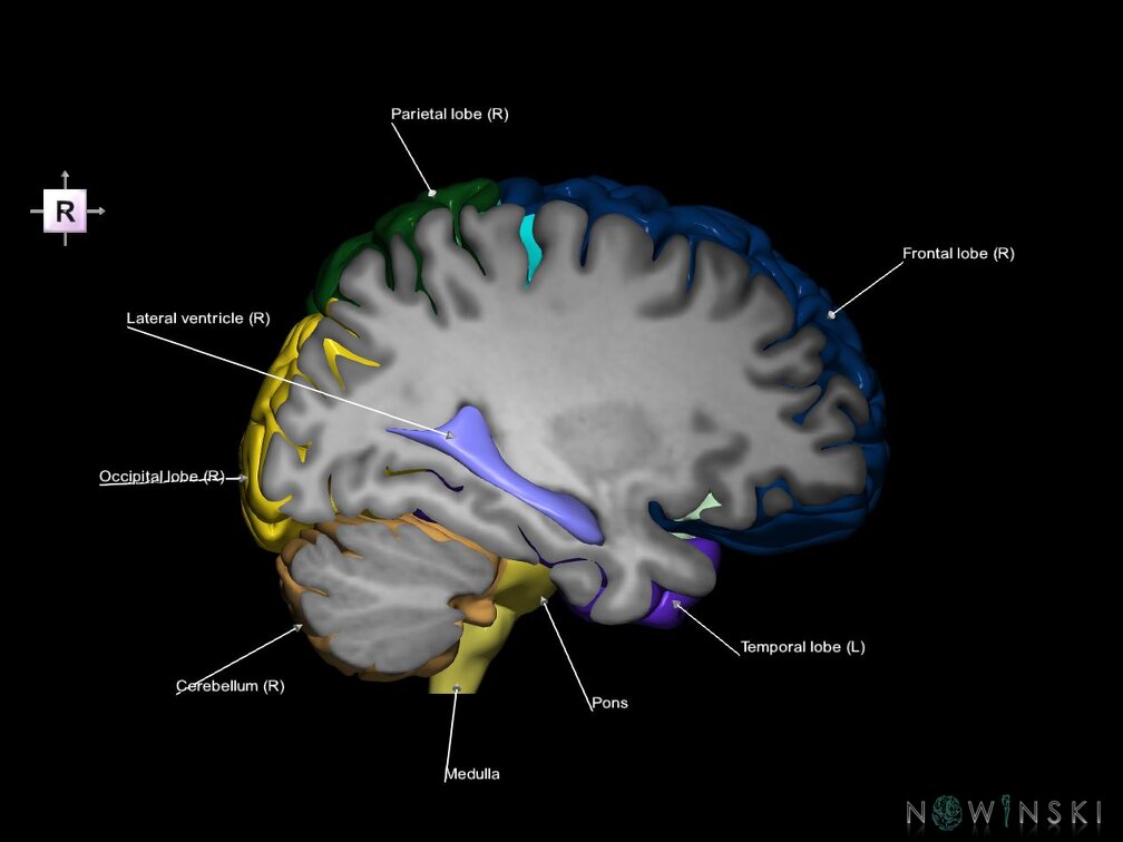 G7.T2.1-12.V4.Dr-30.C2.L1.Brain right cut–Cerebral ventricles