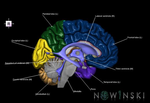 G7.T2.1-12.V4.Dr00.C2.L1.Brain right cut–Cerebral ventricles