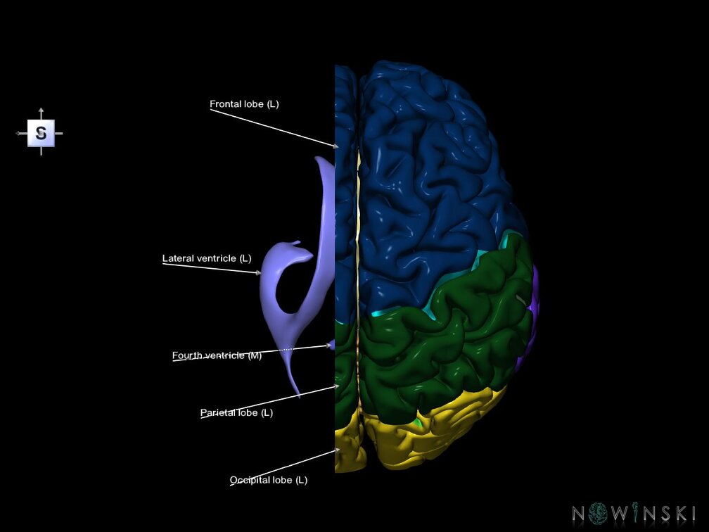 G7.T2.1-12.V5.Dl10.C2.L1.Brain left cut–Cerebral ventricles