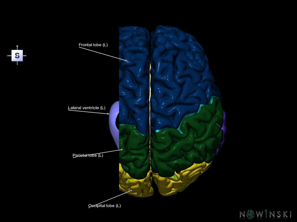 G7.T2.1-12.V5.Dl30.C2.L1.Brain left cut–Cerebral ventricles