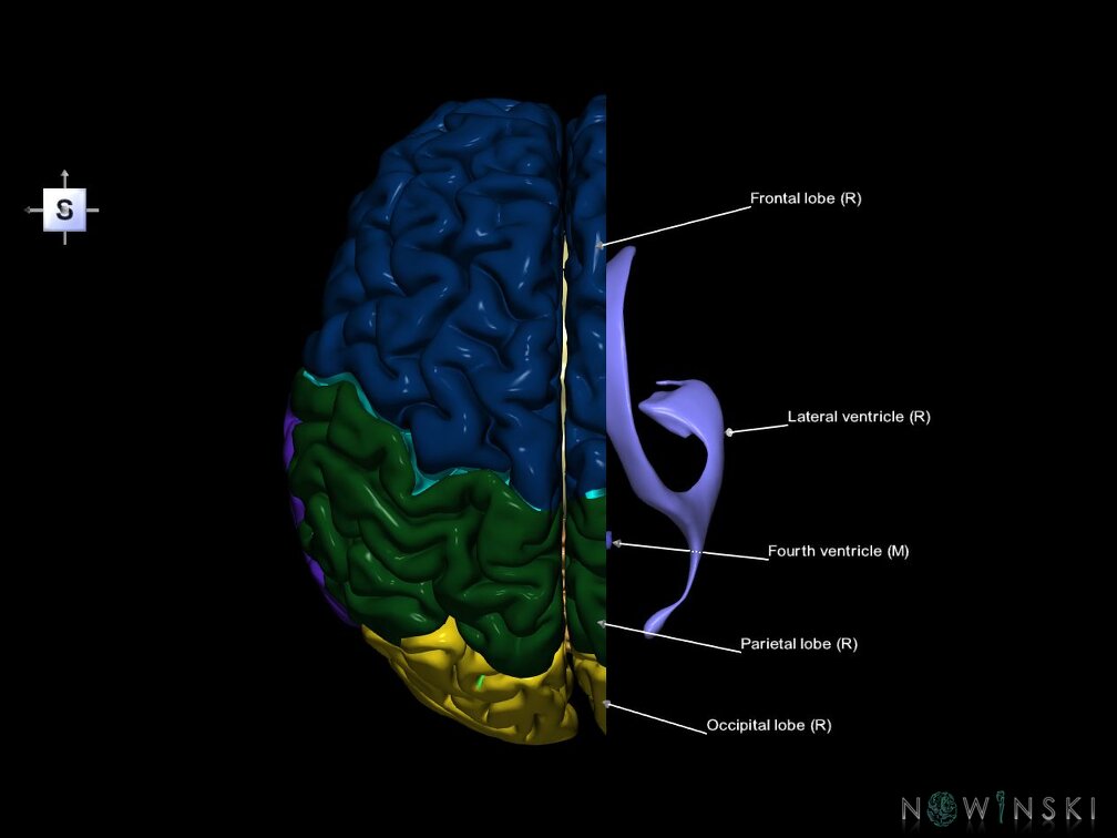 G7.T2.1-12.V5.Dr-10.C2.L1.Brain right cut–Cerebral ventricles