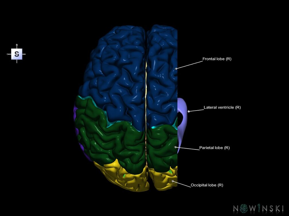 G7.T2.1-12.V5.Dr-30.C2.L1.Brain right cut–Cerebral ventricles