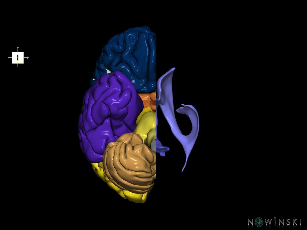 G7.T2.1-12.V6.Dl00.C2.L0.Brain left cut–Cerebral ventricles