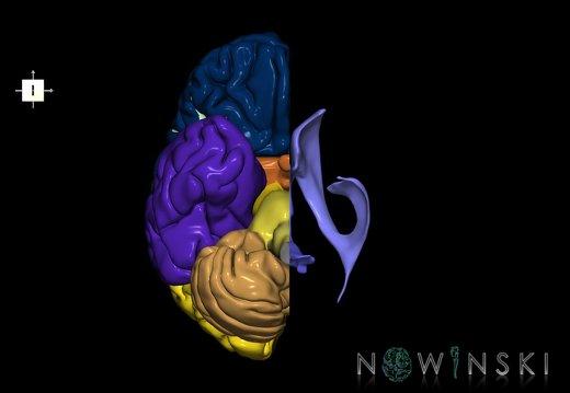 G7.T2.1-12.V6.Dl00.C2.L0.Brain left cut–Cerebral ventricles