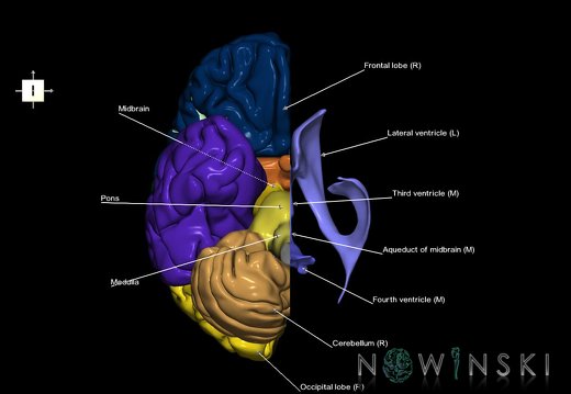 G7.T2.1-12.V6.Dl00.C2.L1.Brain left cut–Cerebral ventricles