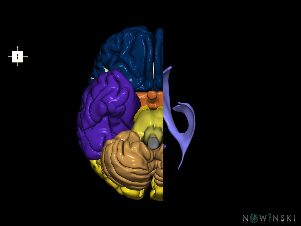 G7.T2.1-12.V6.Dl10.C2.L0.Brain left cut–Cerebral ventricles