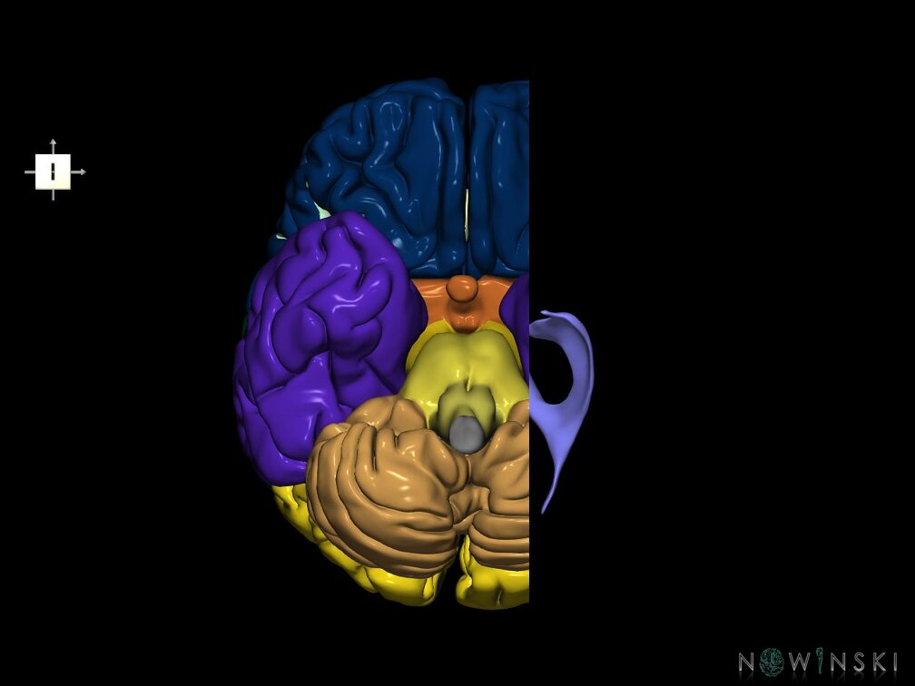 G7.T2.1-12.V6.Dl20.C2.L0.Brain left cut–Cerebral ventricles