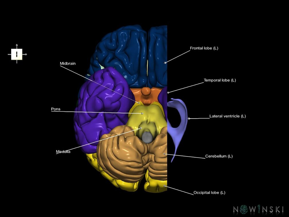 G7.T2.1-12.V6.Dl20.C2.L1.Brain left cut–Cerebral ventricles