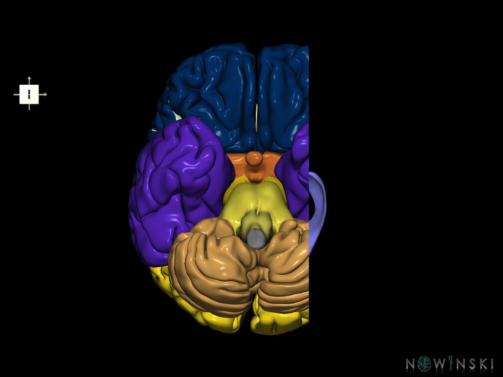 G7.T2.1-12.V6.Dl30.C2.L0.Brain left cut–Cerebral ventricles