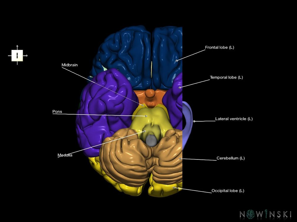 G7.T2.1-12.V6.Dl30.C2.L1.Brain left cut–Cerebral ventricles