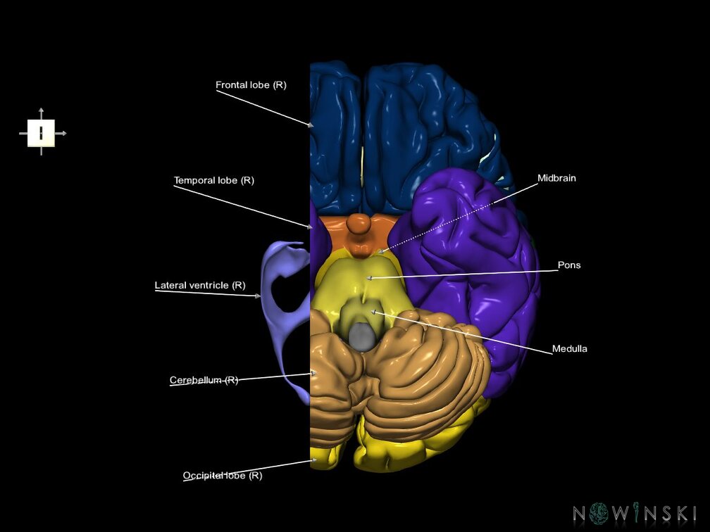 G7.T2.1-12.V6.Dr-20.C2.L1.Brain right cut–Cerebral ventricles
