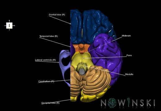 G7.T2.1-12.V6.Dr-20.C2.L1.Brain right cut–Cerebral ventricles