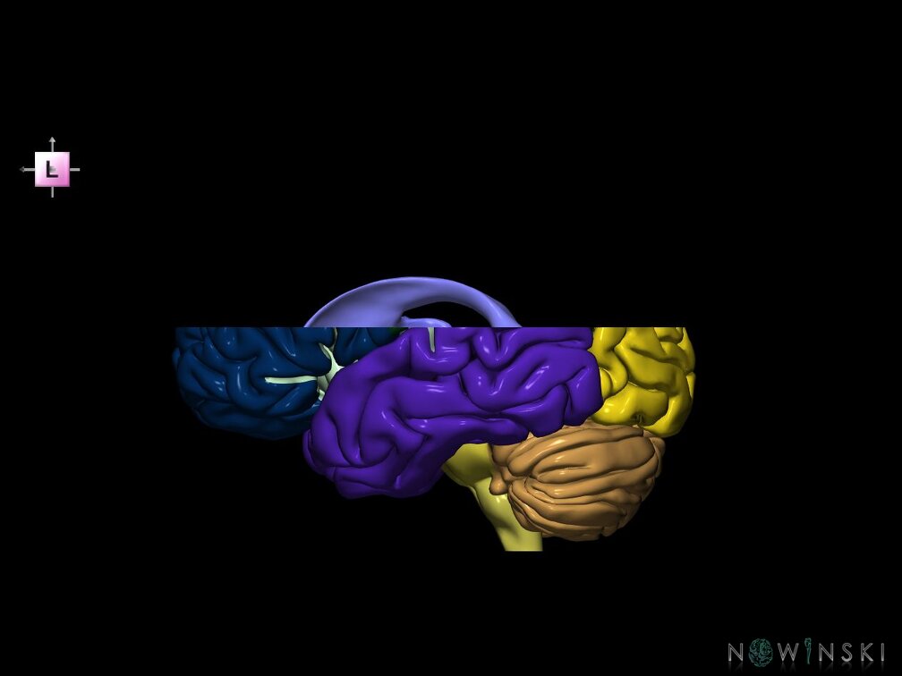 G7.T2.1-12.V2.Ds10.C2.L0.Brain superior cut–Cerebral ventricles