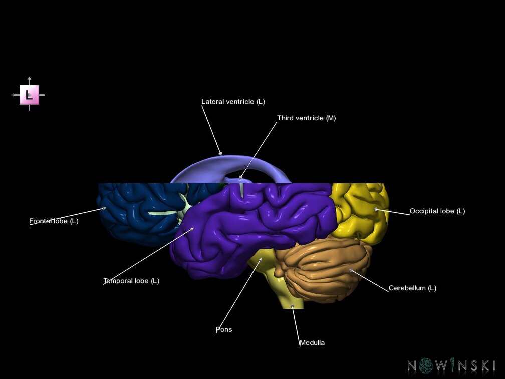 G7.T2.1-12.V2.Ds10.C2.L1.Brain superior cut–Cerebral ventricles