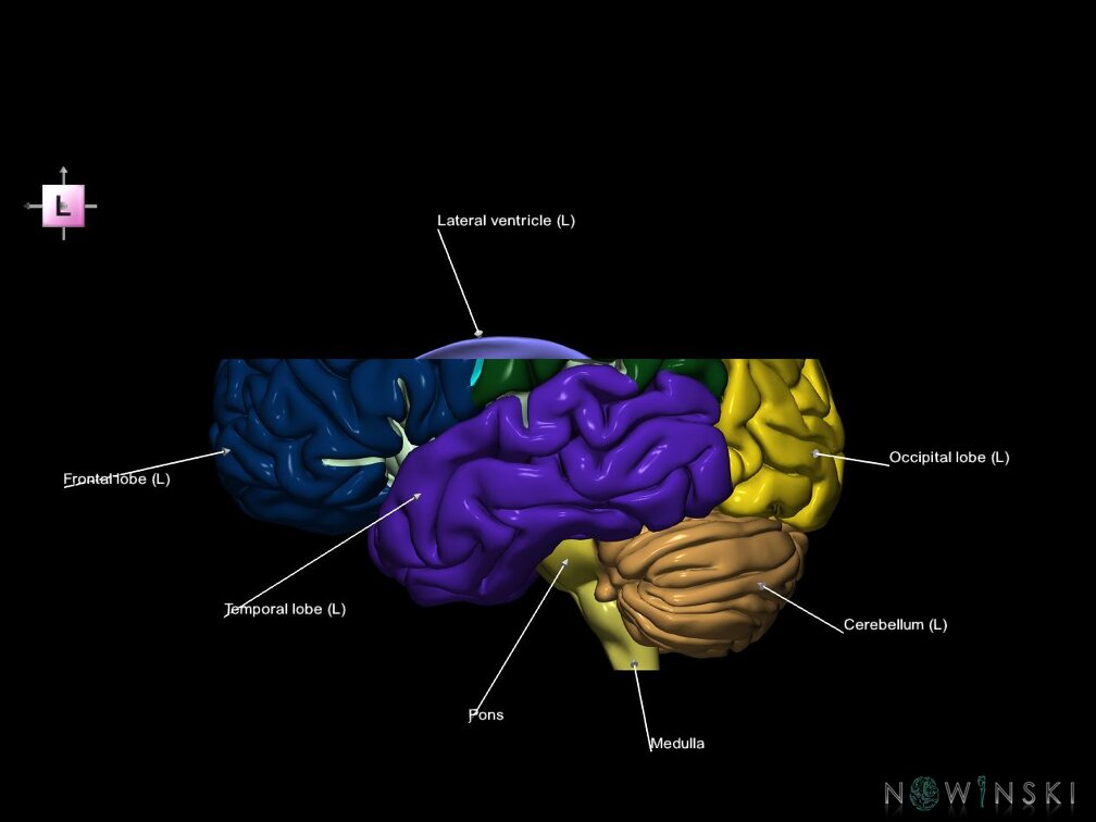 G7.T2.1-12.V2.Ds20.C2.L1.Brain superior cut–Cerebral ventricles