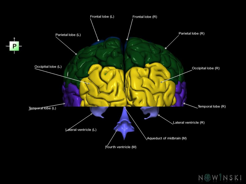 G7.T2.1-12.V3.Di-10.C2.L1.Brain inferior cut–Cerebral ventricles