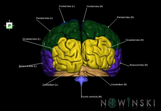 G7.T2.1-12.V3.Di-30.C2.L1.Brain inferior cut–Cerebral ventricles