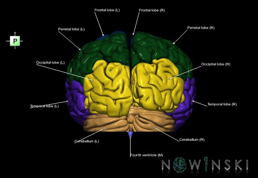 G7.T2.1-12.V3.Di-40.C2.L1.Brain inferior cut–Cerebral ventricles