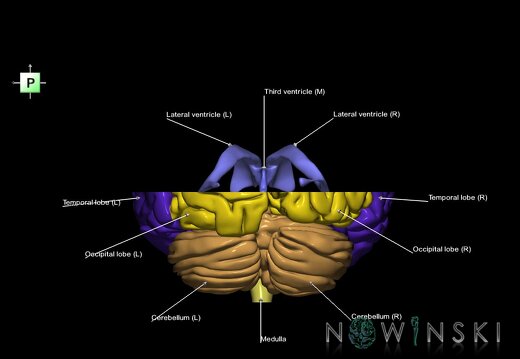 G7.T2.1-12.V3.Ds00.C2.L1.Brain superior cut–Cerebral ventricles