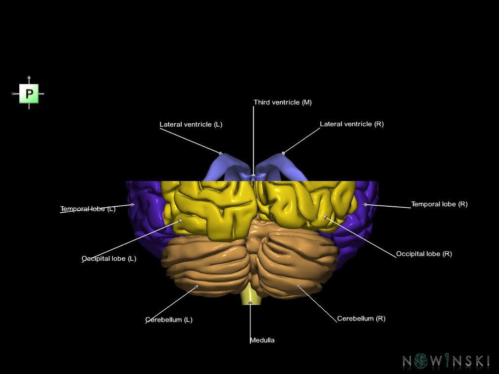 G7.T2.1-12.V3.Ds10.C2.L1.Brain superior cut–Cerebral ventricles