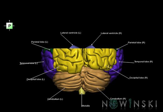 G7.T2.1-12.V3.Ds20.C2.L1.Brain superior cut–Cerebral ventricles